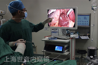 [Laparoscopy in Hepatobiliary Surgery] Exploration through the common gallbladder