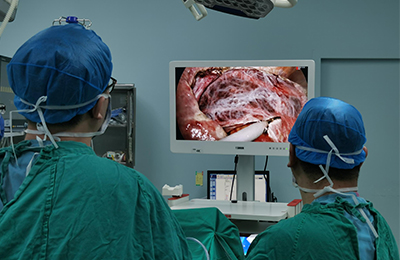 [General Surgery Laparoscopy] 4K Ultra HD Laparoscopic Splenectomy