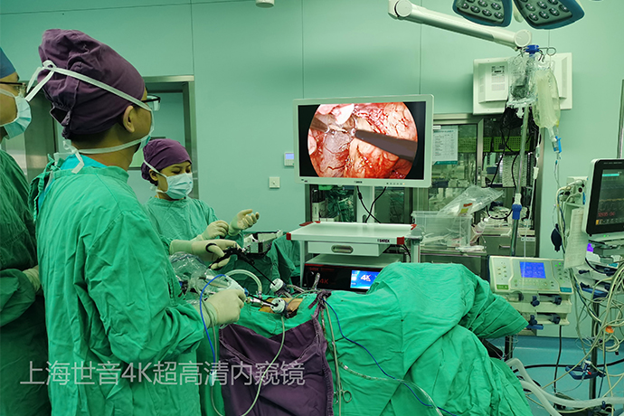 [General Surgery Laparoscopy] 4k ultra-high definition laparoscopy for prostate cancer