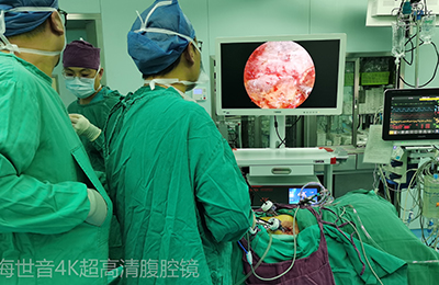 [General Surgery Laparoscopy] 4K ultra-high definition laparoscopic radical nephrectomy