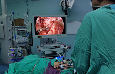 [General Surgery Laparoscopy] 4K ultra-high definition laparoscopic deroofing and decompression of renal cysts