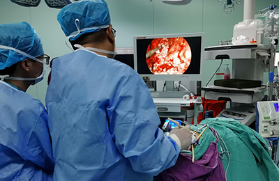 [General Surgery Laparoscopy] 4K ultra-high definition laparoscopic pyeloplasty