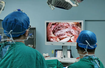 [General Surgery Laparoscopy] 4K ultra-high definition laparoscopic pancreatic body and tail resection treatment