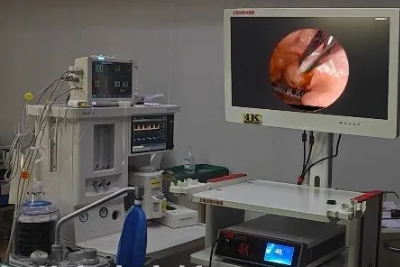 [Laryngoscopy in Otolaryngology] Tonsillectomy