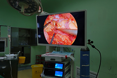 4K And 3D Laparoscopic Camera System